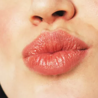 Міфи і правда про збільшення губ: розповідає ін’єкціоніст